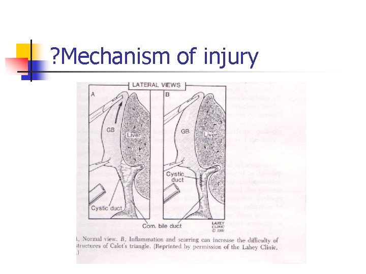? Mechanism of injury 
