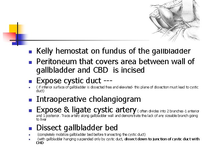 n n n Kelly hemostat on fundus of the gallbladder Peritoneum that covers area