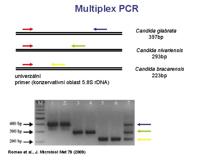 Multiplex PCR Candida glabrata 397 bp Candida nivariensis 293 bp univerzální primer (konzervativní oblast