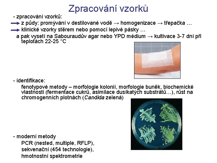 Zpracování vzorků - zpracování vzorků: z půdy: promývání v destilované vodě → homogenizace →