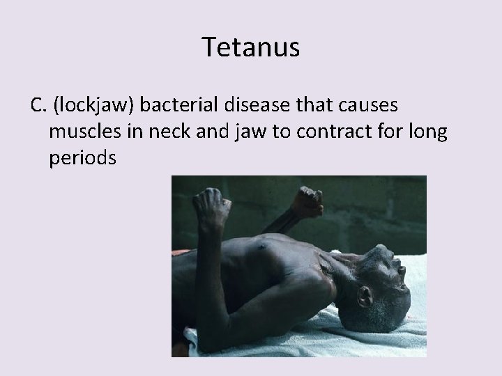 Tetanus C. (lockjaw) bacterial disease that causes muscles in neck and jaw to contract