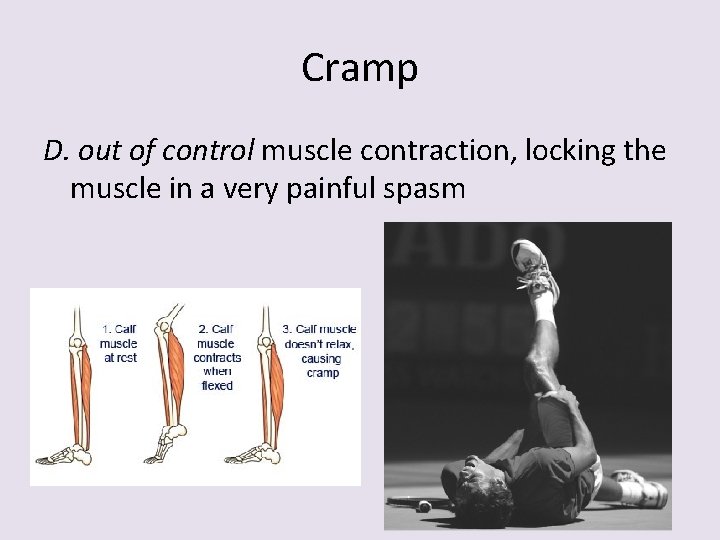 Cramp D. out of control muscle contraction, locking the muscle in a very painful