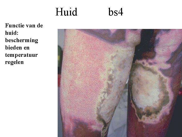 Huid Functie van de huid: bescherming bieden en temperatuur regelen bs 4 