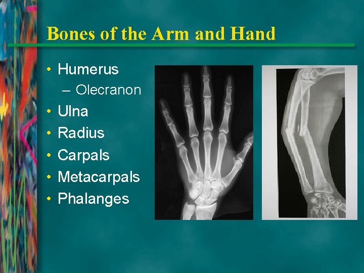 Bones of the Arm and Hand • Humerus – Olecranon • • • Ulna
