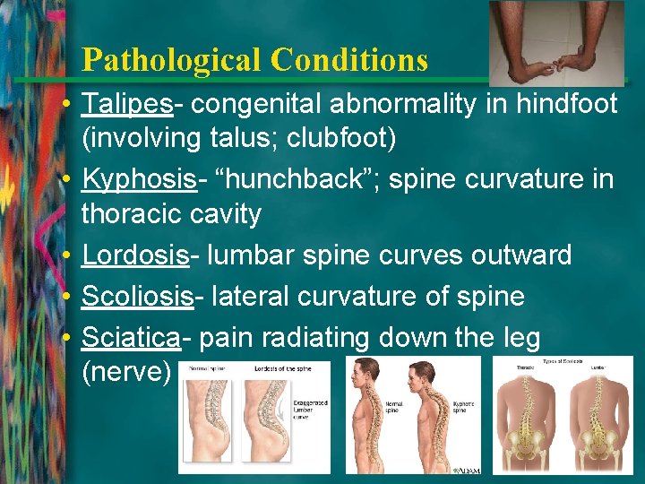 Pathological Conditions • Talipes- congenital abnormality in hindfoot (involving talus; clubfoot) • Kyphosis- “hunchback”;