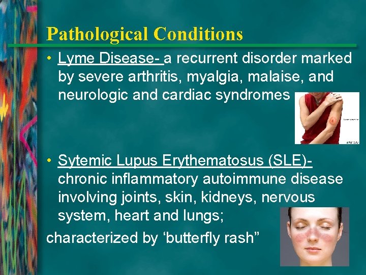 Pathological Conditions • Lyme Disease- a recurrent disorder marked by severe arthritis, myalgia, malaise,