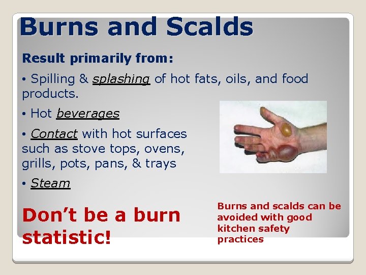 Burns and Scalds Result primarily from: • Spilling & splashing of hot fats, oils,