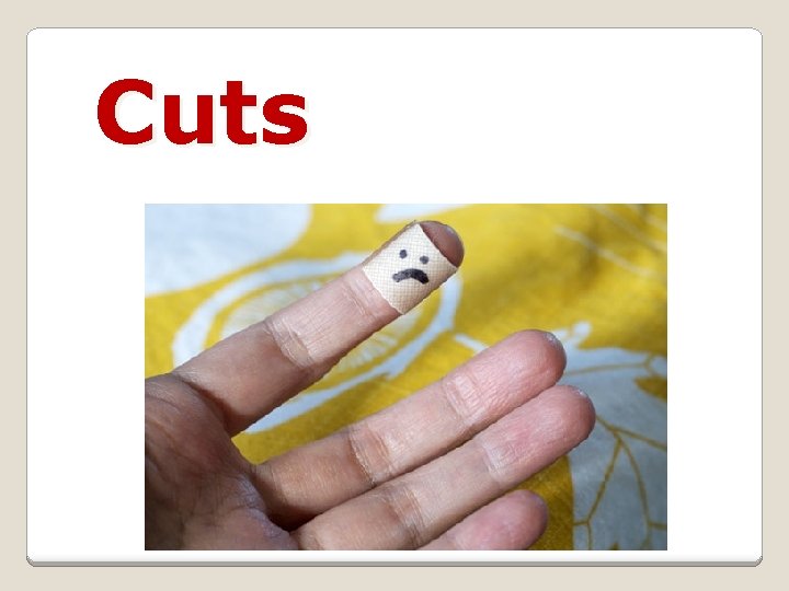 Cuts 