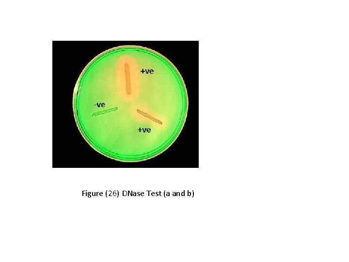 Figure (26) DNase Test (a and b) 