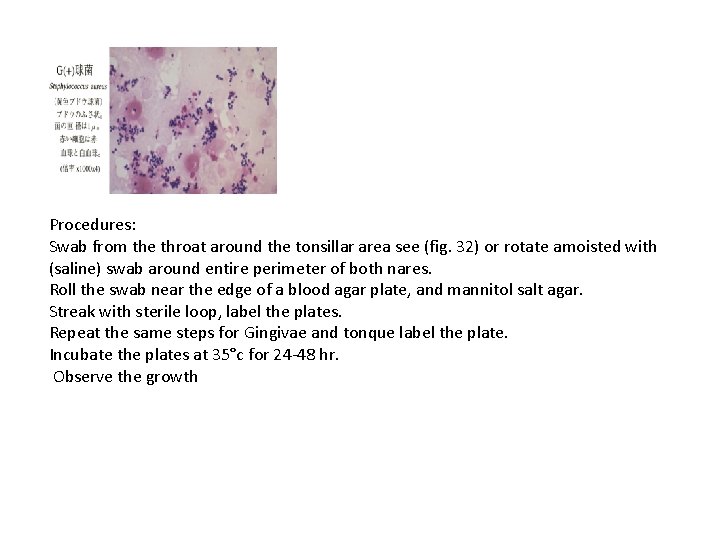 Procedures: Swab from the throat around the tonsillar area see (fig. 32) or rotate