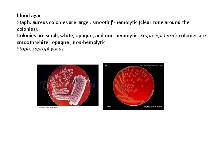 blood agar Staph. aureus colonies are large , smooth β-hemolytic (clear zone around the