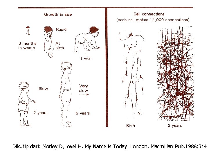 Dikutip dari: Morley D, Lovel H. My Name is Today. London. Macmillan Pub. 1986;