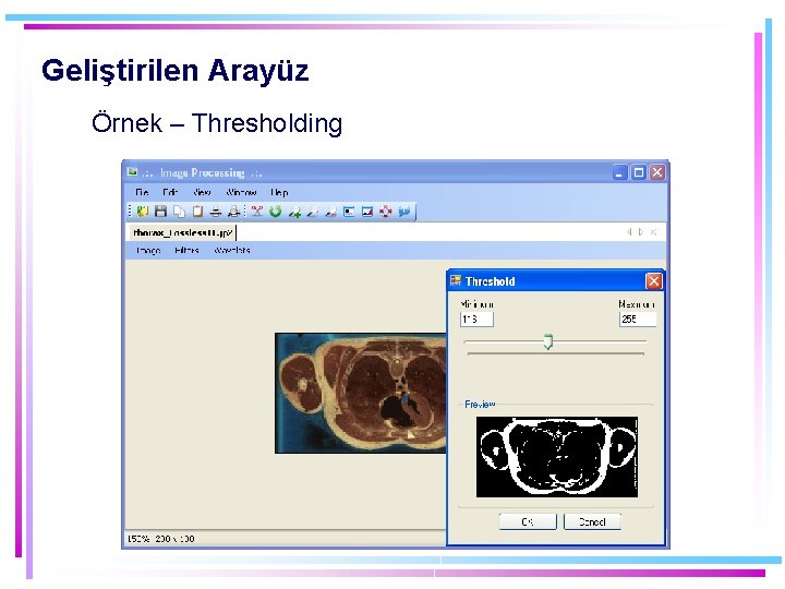 Geliştirilen Arayüz Örnek – Thresholding 