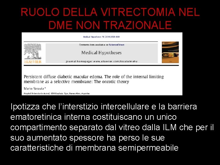 RUOLO DELLA VITRECTOMIA NEL DME NON TRAZIONALE Ipotizza che l’interstizio intercellulare e la barriera