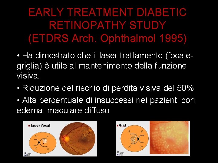EARLY TREATMENT DIABETIC RETINOPATHY STUDY (ETDRS Arch. Ophthalmol 1995) • Ha dimostrato che il