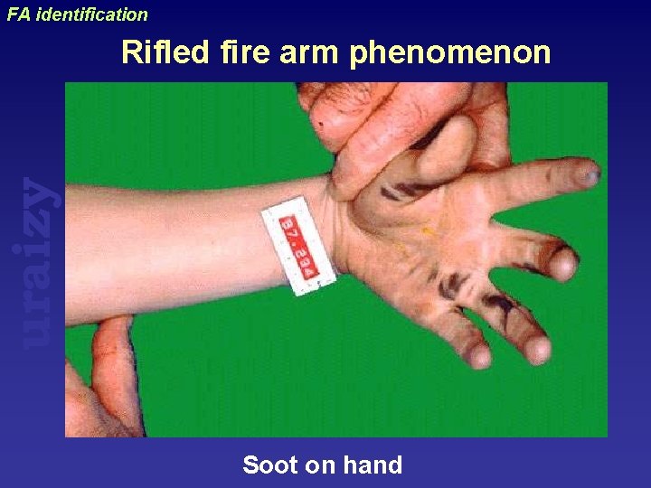 FA identification uraizy Rifled fire arm phenomenon Soot on hand 