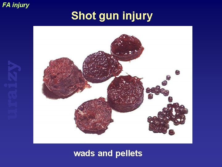 FA injury uraizy Shot gun injury wads and pellets 