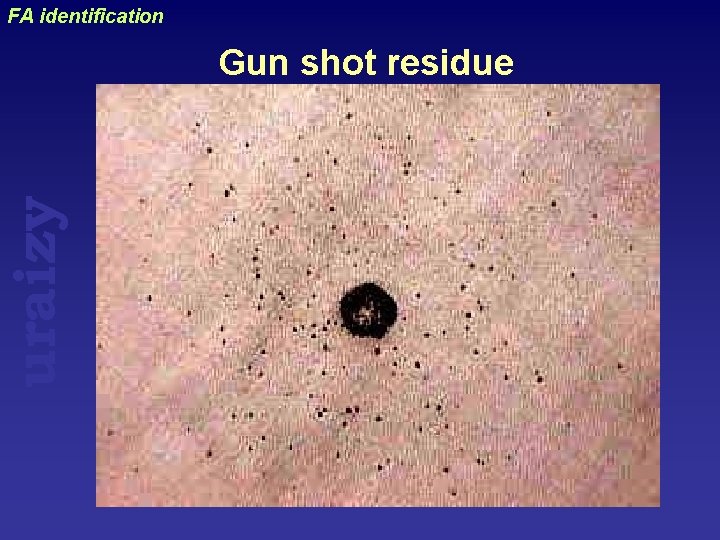 uraizy FA identification Gun shot residue 