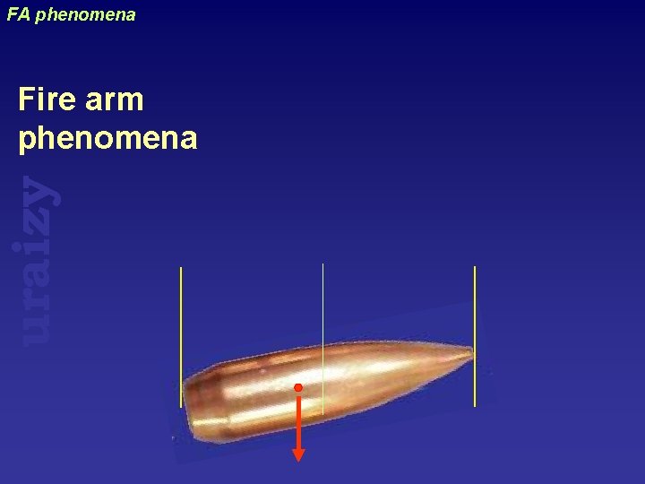 FA phenomena uraizy Fire arm phenomena 