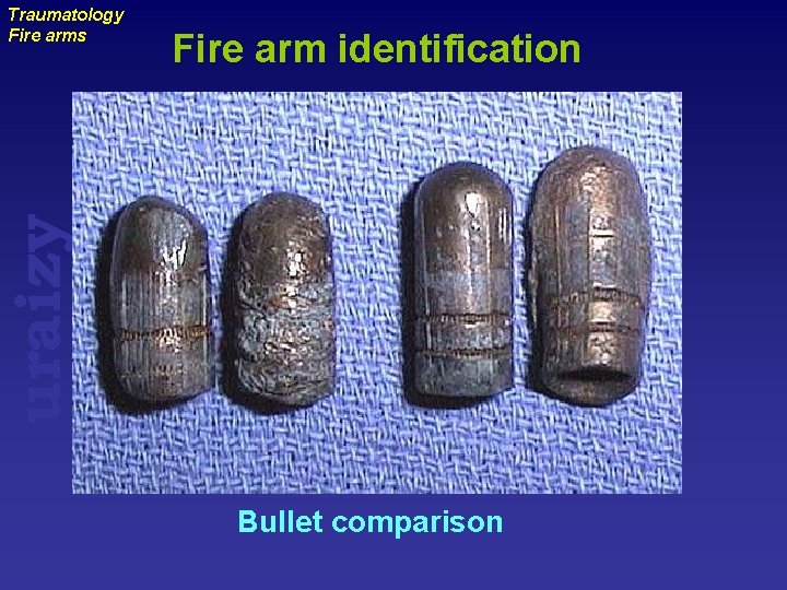 Fire arm identification uraizy Traumatology Fire arms Bullet comparison 
