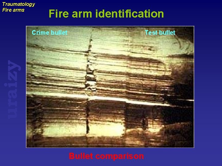 Traumatology Fire arms Fire arm identification Test bullet uraizy Crime bullet Bullet comparison 