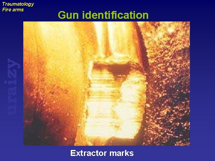 Gun identification uraizy Traumatology Fire arms Extractor marks 