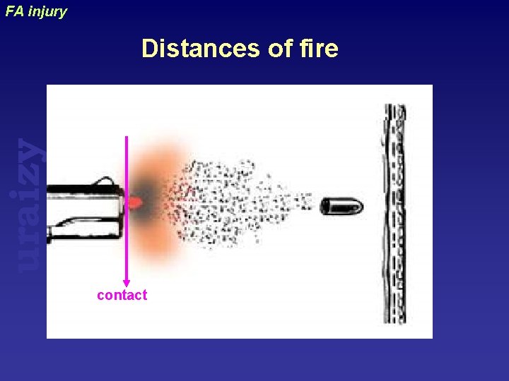 FA injury uraizy Distances of fire contact 