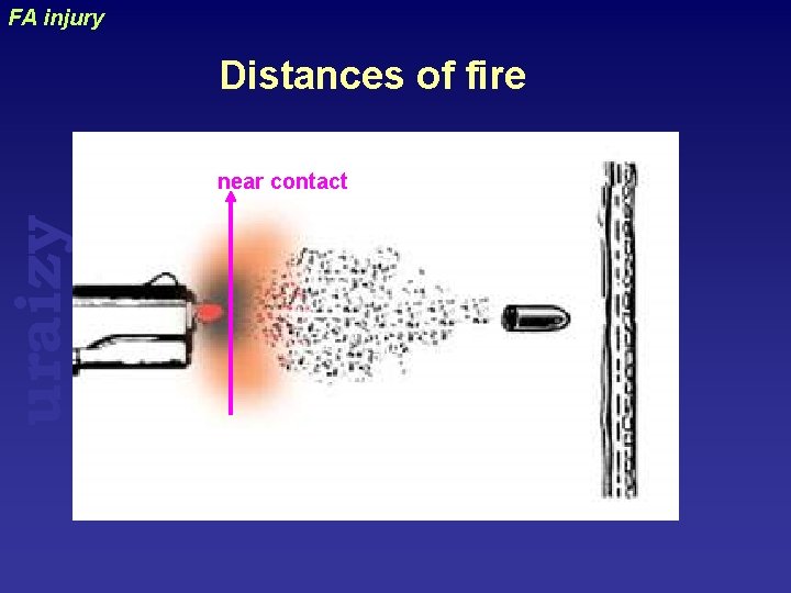 uraizy FA injury Distances of fire near contact 