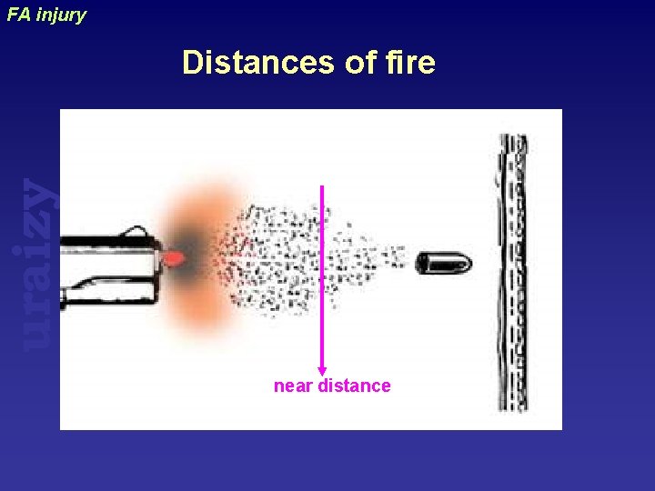 FA injury uraizy Distances of fire near distance 
