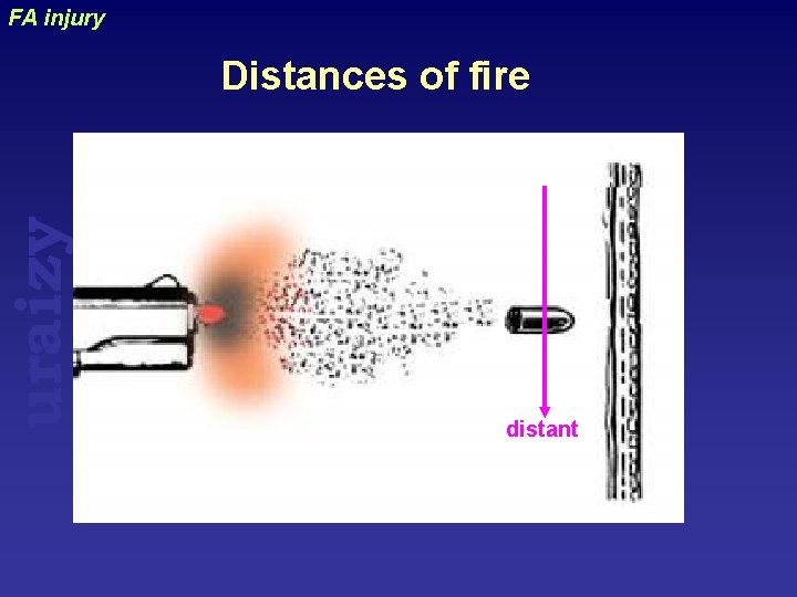 uraizy FA injury Distances of fire distant 