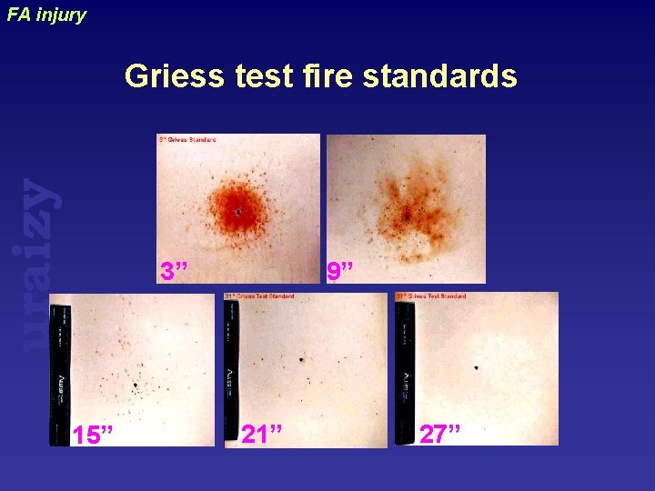 FA injury uraizy Griess test fire standards 3” 15” 9” 21” 27” 