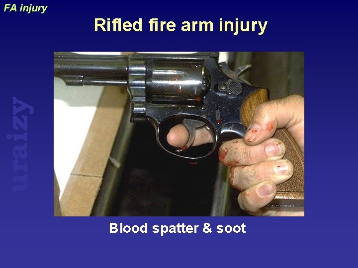 FA injury uraizy Rifled fire arm injury Blood spatter & soot 