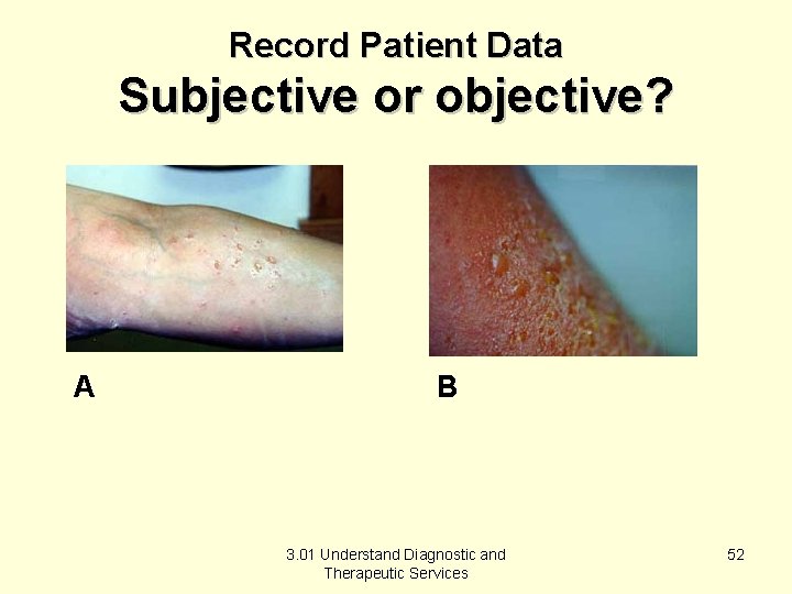 Record Patient Data Subjective or objective? A B 3. 01 Understand Diagnostic and Therapeutic