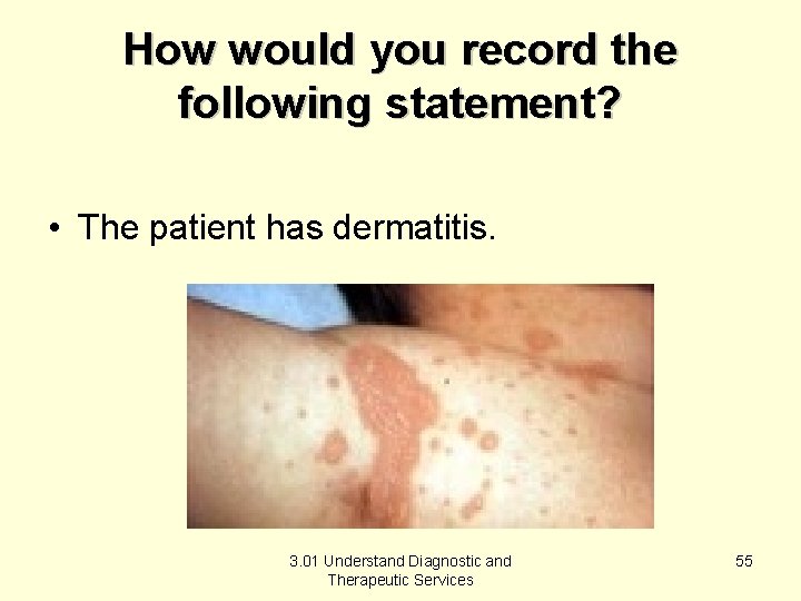 How would you record the following statement? • The patient has dermatitis. 3. 01