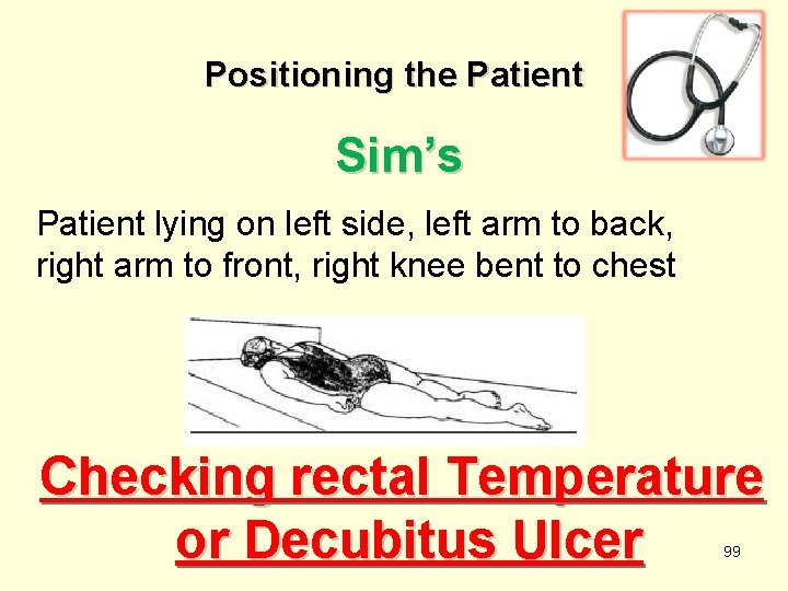 Positioning the Patient Sim’s Patient lying on left side, left arm to back, right