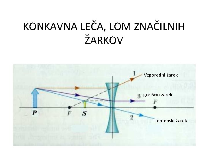 KONKAVNA LEČA, LOM ZNAČILNIH ŽARKOV Vzporedni žarek goriščni žarek temenski žarek 