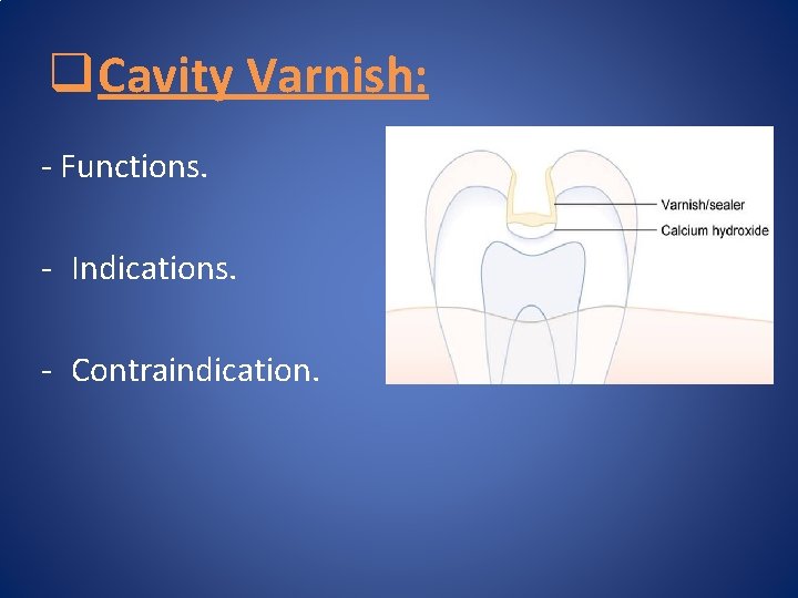 q Cavity Varnish: - Functions. - Indications. - Contraindication. 