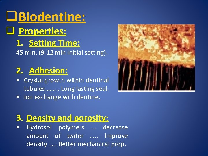 q Biodentine: q Properties: 1. Setting Time: 45 min. (9 -12 min initial setting).