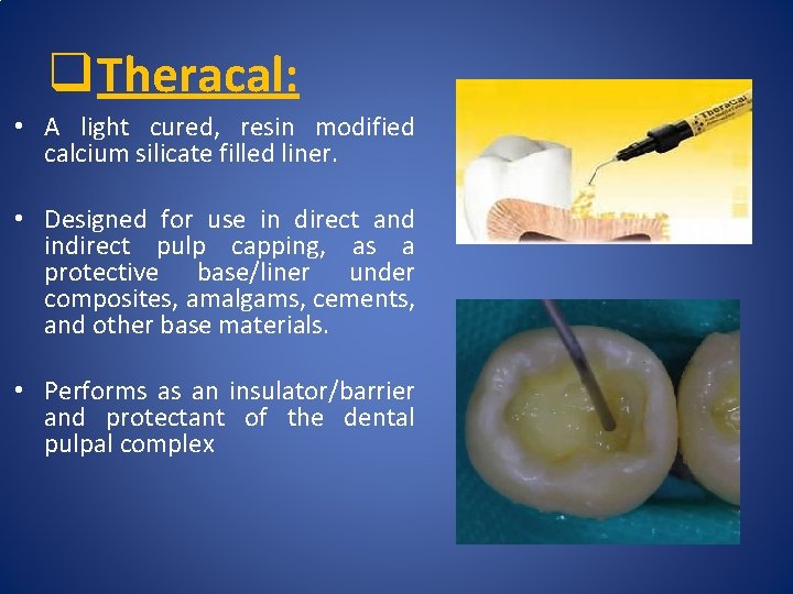 q Theracal: • A light cured, resin modified calcium silicate filled liner. • Designed