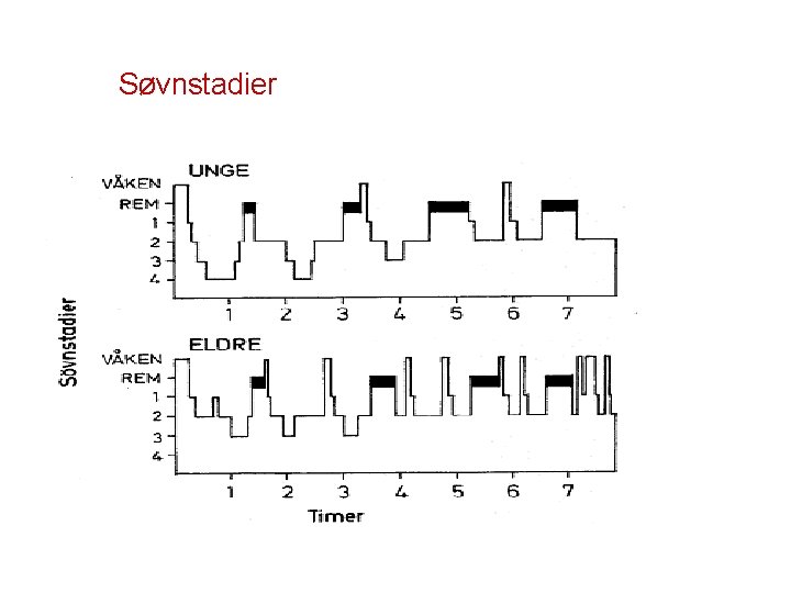 Søvnstadier 