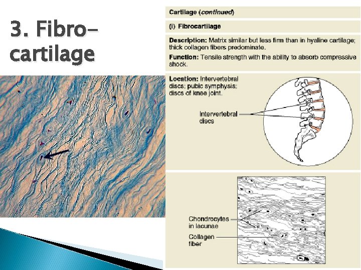 3. Fibrocartilage Figure 4. 8 i 