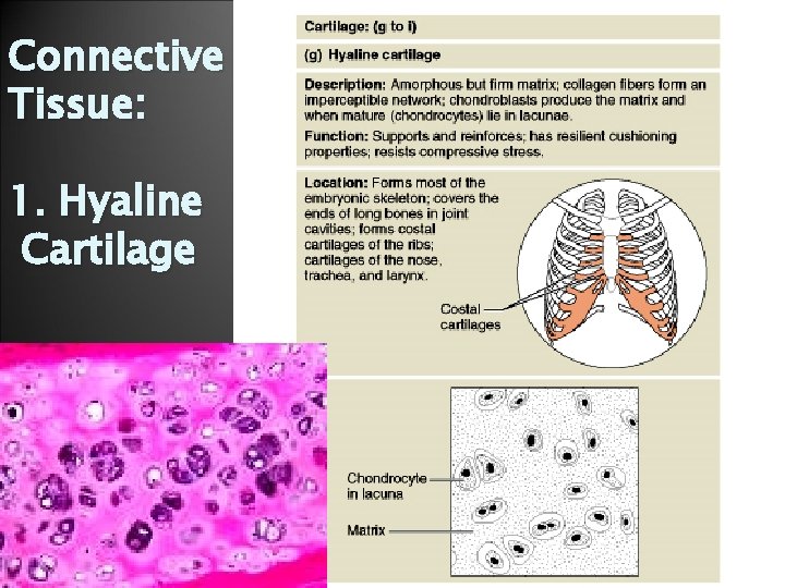 Connective Tissue: 1. Hyaline Cartilage 