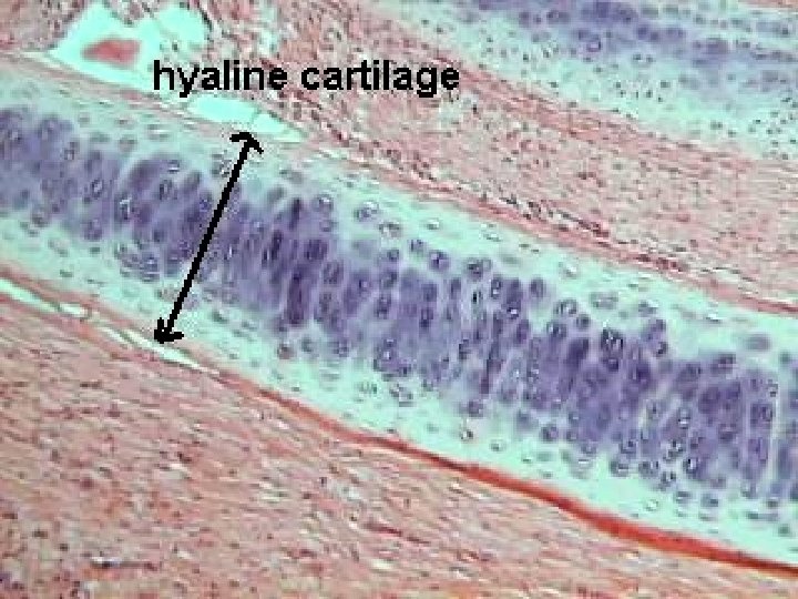 Hyaline cartilage 