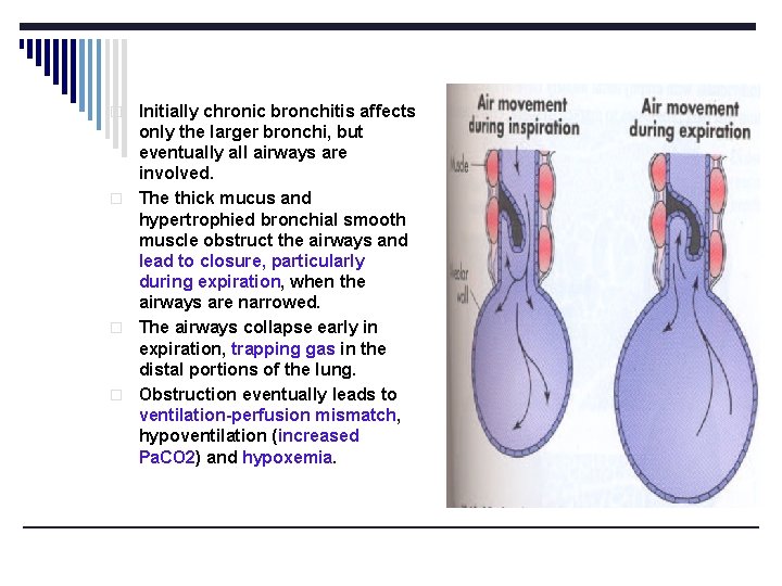 Initially chronic bronchitis affects only the larger bronchi, but eventually all airways are involved.