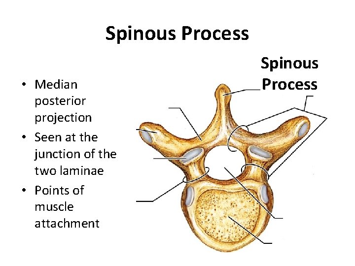 Spinous Process • Median posterior projection • Seen at the junction of the two
