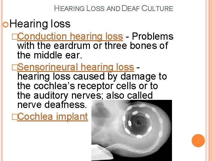 HEARING LOSS AND DEAF CULTURE Hearing loss �Conduction hearing loss - Problems with the HEARING LOSS AND DEAF CULTURE Hearing loss �Conduction hearing loss - Problems with the