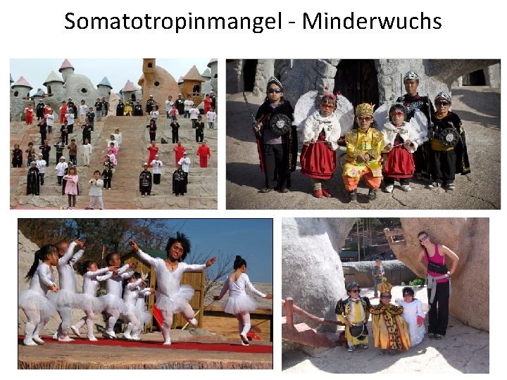 Somatotropinmangel - Minderwuchs 