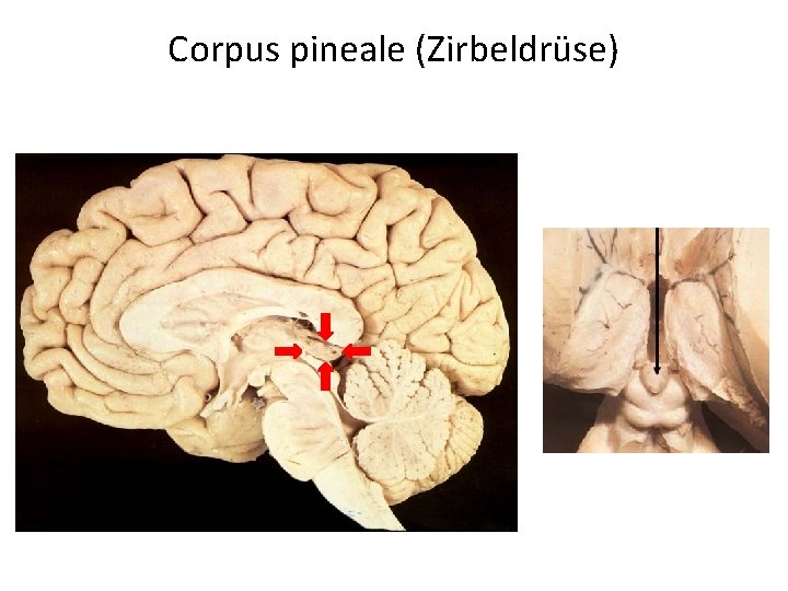 Corpus pineale (Zirbeldrüse) 