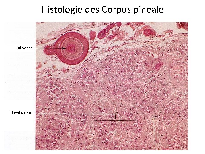 Histologie des Corpus pineale Hirnsand Pinealozyten 
