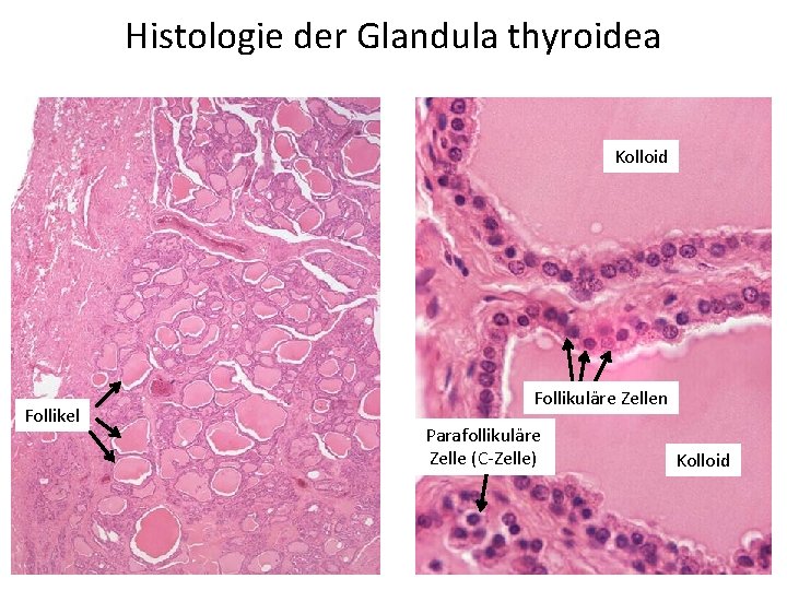 Histologie der Glandula thyroidea Kolloid Follikel Follikuläre Zellen Parafollikuläre Zelle (C-Zelle) Kolloid 